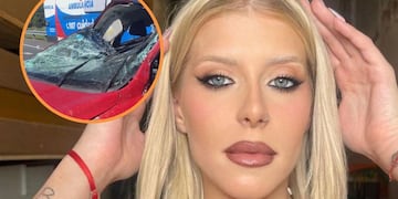 Camila Lattanzio, la ex Gran Hermano, reapareció tras su grave accidente y mostró su estado: “La saqué barata”