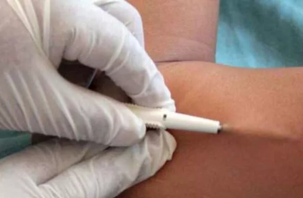 Jornada de acceso a métodos anticonceptivos en Garupá