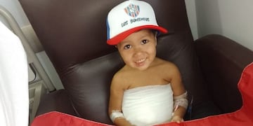 Él es Dilan Chávez, el pequeño de 2 años que fue mordido por un perro en Chimbas.