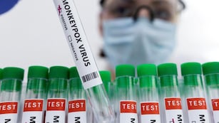 Argentina confirmó el sexto caso de viruela del mono.