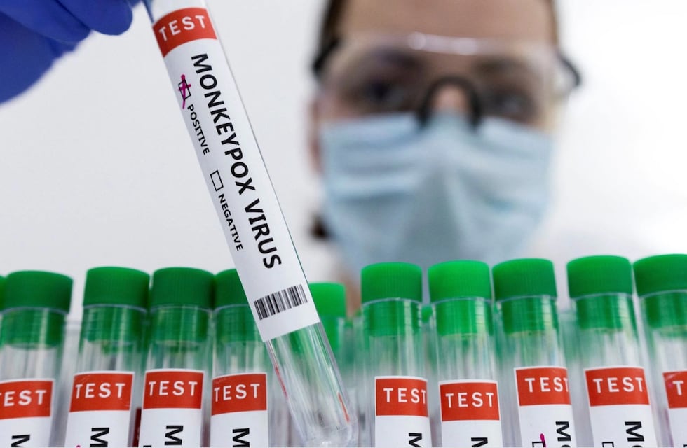 Viruela del mono: la OMS hace un llamado para contener el brote