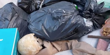 Encontraron un cráneo humano en un contenedor de basura en Mar del Plata e investigan su procedencia. (Gentileza)