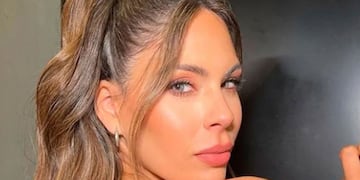 Barby Franco se realizó una drástica cirugía y causó polémica en sus redes: “Me creo mil...”