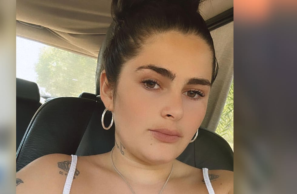 Kami Franco se mostró tras su cirugía estética y las fotos despertaron polémica en las redes