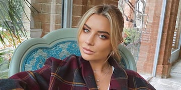 Lucir con orgullo las ojeras, la nueva moda de los más jóvenes.