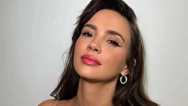 El impactante antes y después de Celeste Cid que dejó a todos en shock: “¿Qué le pasó en la cara?”.