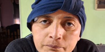 Romina vive en Punta Alta y es paciente oncológica desde el 2014