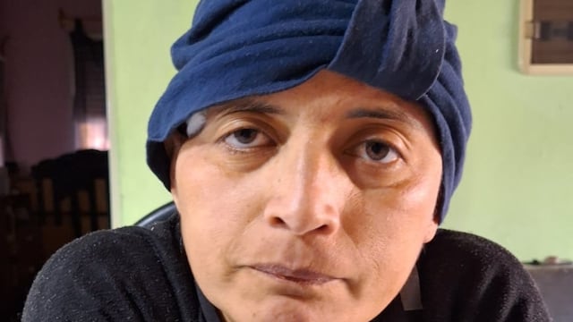 Romina vive en Punta Alta y es paciente oncológica desde el 2014