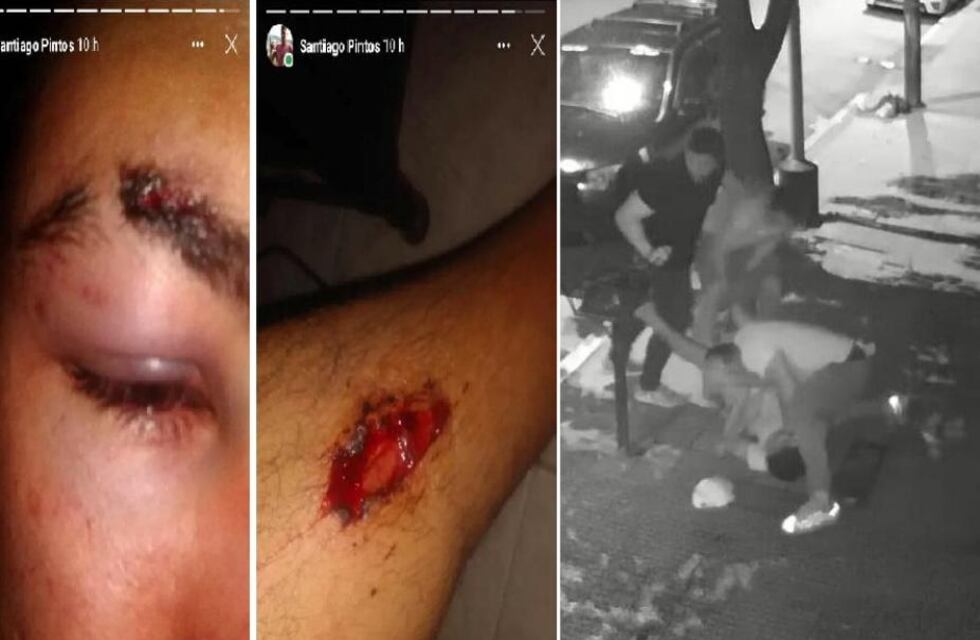 Concepción: golpearon brutalmente a un joven a la salida de un pub