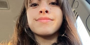 Luana padece un extraño tipo de cáncer