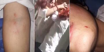 Violencia estudiantil: imágenes impactantes que dejó la pelea entre alumanas en San Juan.