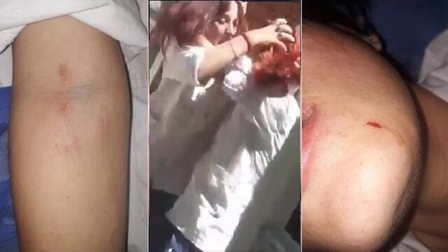 Violencia estudiantil: imágenes impactantes que dejó la pelea entre alumanas en San Juan.