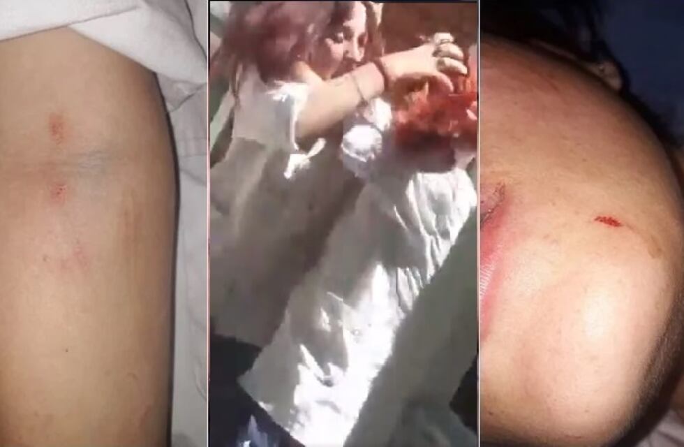 Video viral: feroz paliza entre alumnas en San Juan, una fue internada