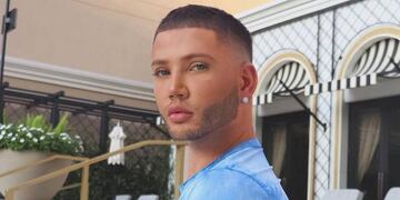 Cómo es el Ken Kardashian, el hombre que gastó miles de dólares para operarse la cola y parecerse al muñeco