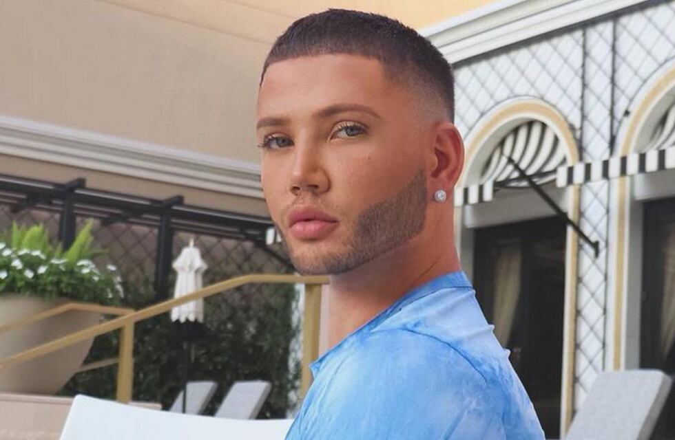 Cómo es el Ken Kardashian, el hombre que gastó miles de dólares para operarse la cola y parecerse al muñeco