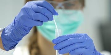 An employee of the diagnostics provider R-Biopharm works on a probe during the presentation of a rapid antigen test to detect the SARS-CoV-2 antigen at their laboratory in Pfungstadt near Darmstadt, Germany October 8, 2020\u002E   REUTERS/Ralph Orlowski