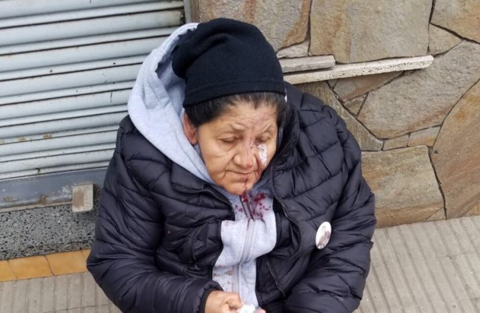 Cinco delincuentes rodearon a una mujer, la golpearon salvajemente y le robaron todo