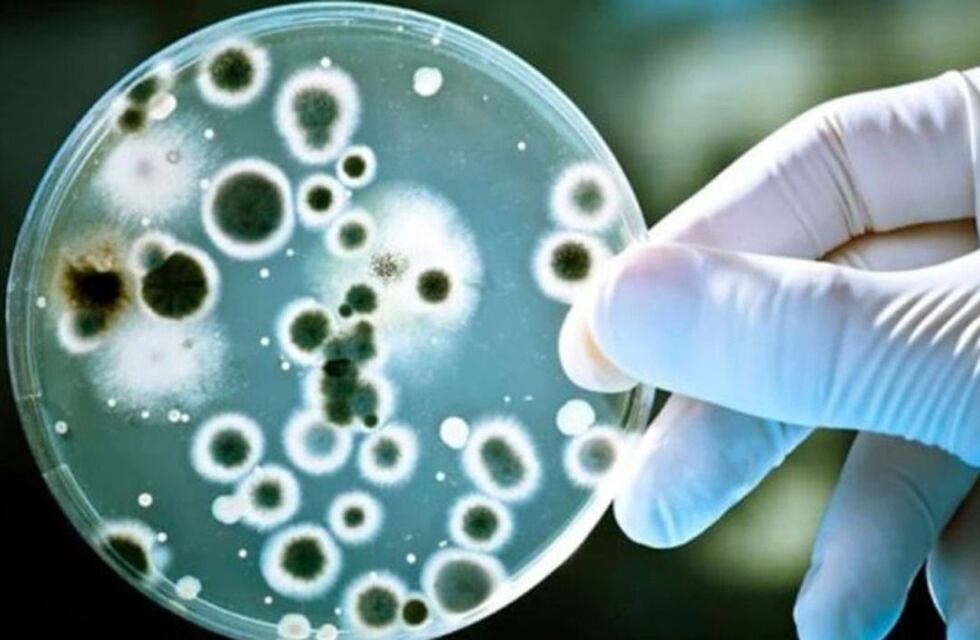 Qué es el Streptococcus pyogenes, la bacteria que afecta a casi 500 personas en el país