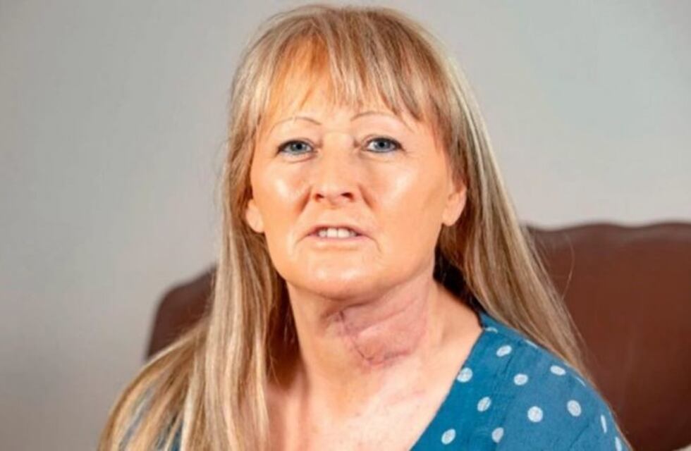 Tuvo cáncer y pudieron reconstruir su lengua con piel del brazo