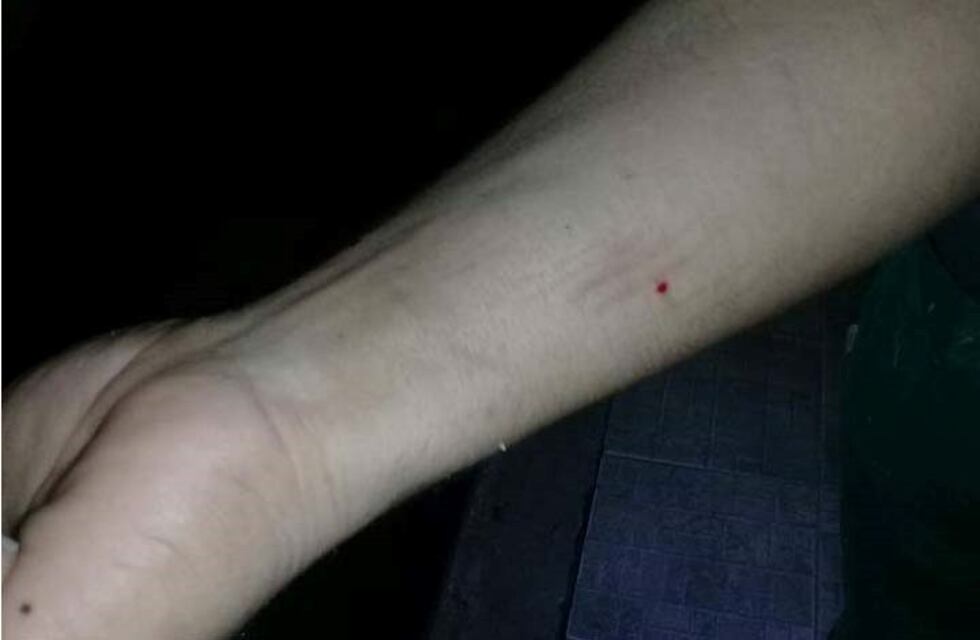 Desesperado pedido de un recolector que se pinchó con una jeringa y espera los resultados de los análisis