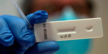 Coronavirus test\u002E