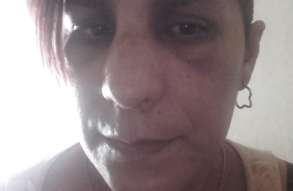 El calvario de Virginia: "Me aflojó toda la dentadura de una piña"