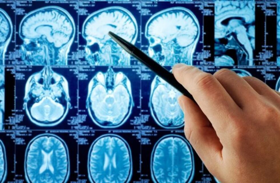 Registran actividad cerebral después de la muerte