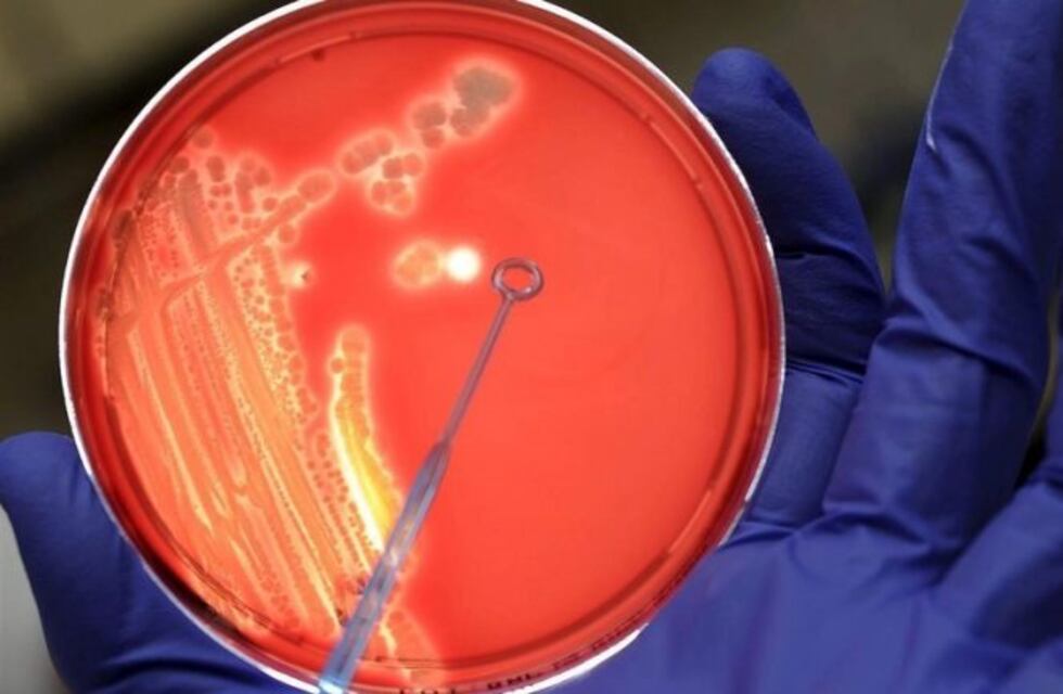 Está fuera de peligro el menor con streptococcus pyogenes en Mendoza