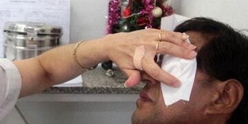 Un hombre perdió un ojo por pirotecnia durante la madrugada\u002E (Web)\u002E