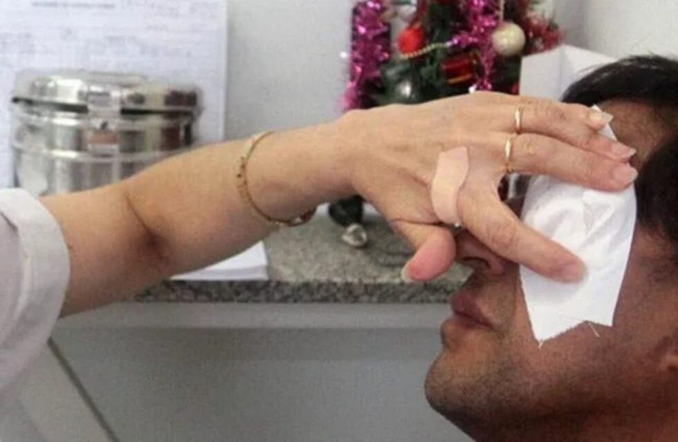 Un hombre perdió un ojo  por pirotecnia durante la madrugada