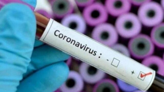 En las islas se realizaron 2682 pruebas para detectar el virus COVID-19. Llevan casi 170 días sin casos positivos.