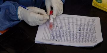 Coronavirus test\u002E