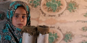 Las prótesis que el papá de Maya fabricó\u002E AP