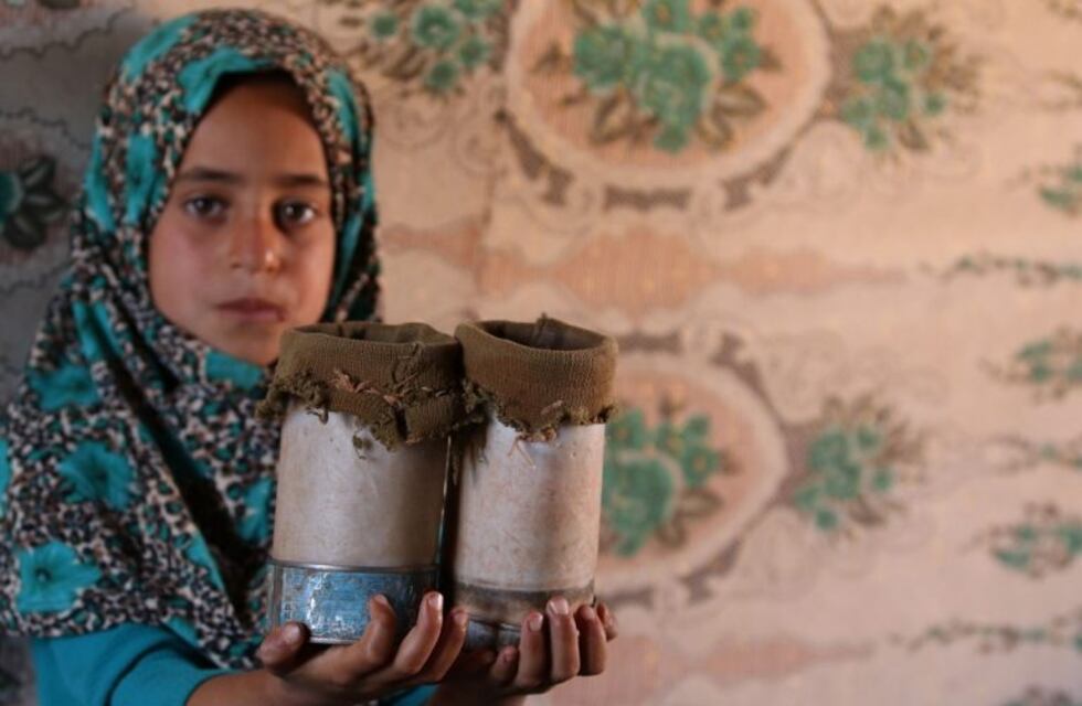 La nena siria que usa latas de conserva en lugar de prótesis, podrá caminar