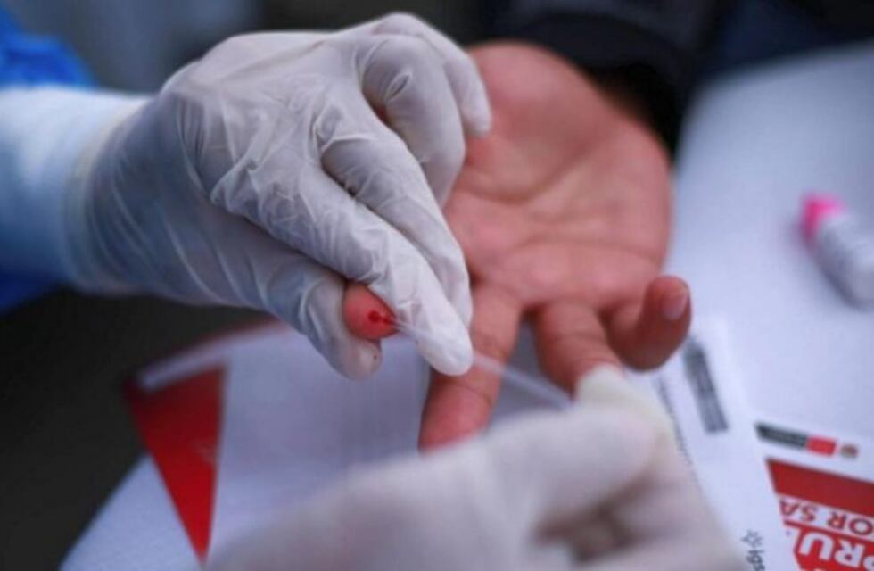 Por el Día de la lucha contra el SIDA, se realizarán testeos gratuitos en Carlos Paz