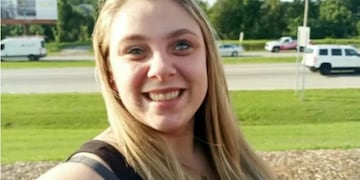 Mujer recibe protesis ocular