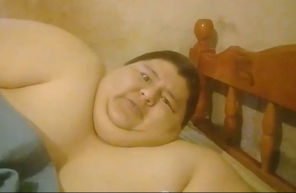 Falleció Nelson: el joven sufría obesidad mórbida y tenía una hernia de casi 40 kilos