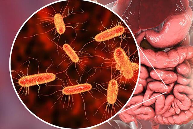 Síndrome Urémico Hemolítico