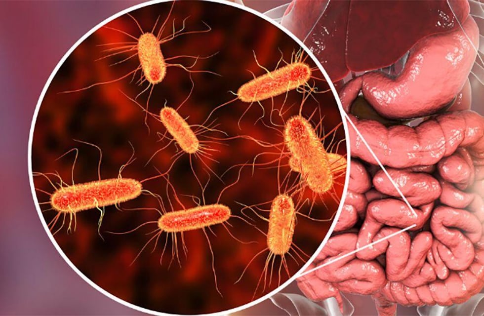 Síndrome Urémico Hemolítico: claves para prevenir una enfermedad grave y evitable