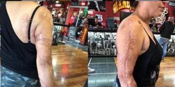 Vio a una mujer con los dos brazos quemados y le ofreció hacerle un tatuaje: el resultado es increíble