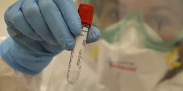 El ministerio de Salud de la provincia informó que hasta hoy hay 23\u002E171 pacientes recuperados de Covid-19\u002E