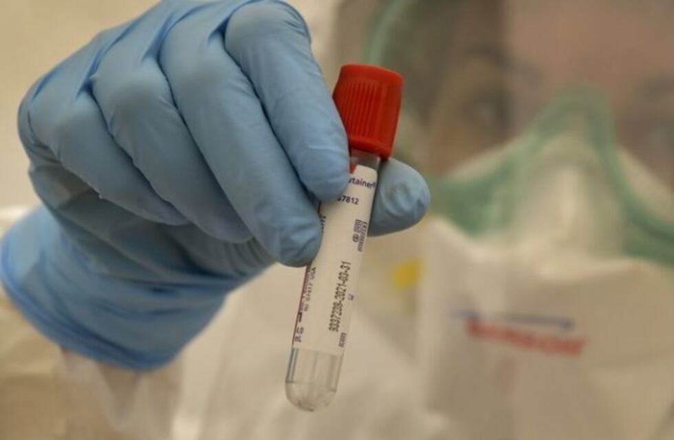 Coronavirus en Mendoza: hoy hubo 600 nuevos casos y 13 muertos