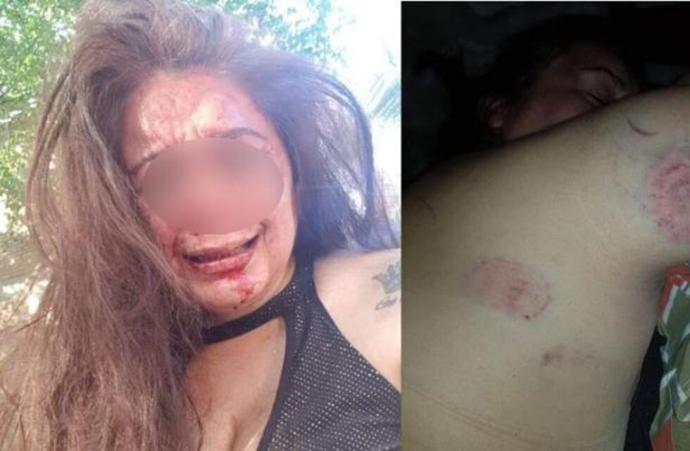 Un policía golpeó salvajemente a su pareja y ella lo denunció por Facebook