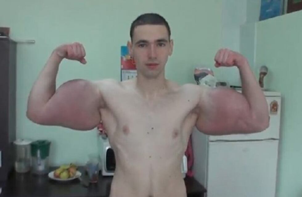 El Hulk ruso que no puede más del dolor: "Pido a Dios la muerte"