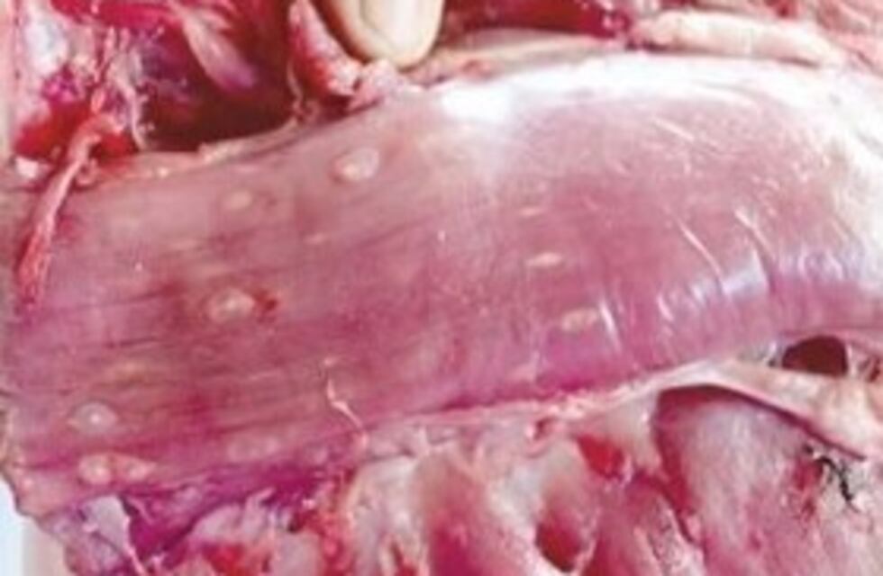 La Rioja: estudian cuatro posibles casos de triquinosis