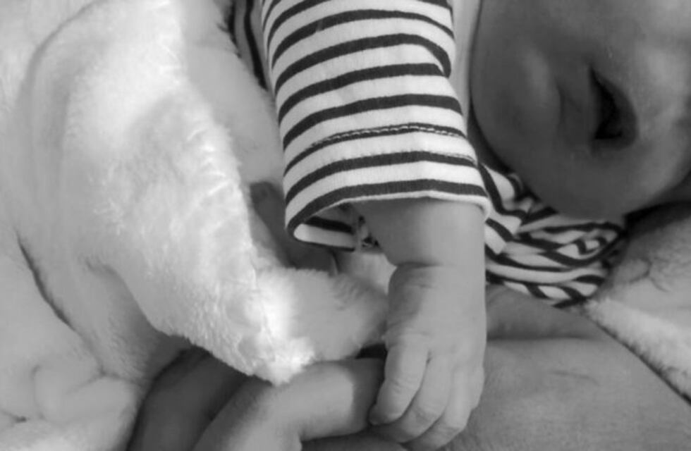 Rodrigo, "el bebé sin rostro", cumplió cuatro meses desafiando todos los pronósticos