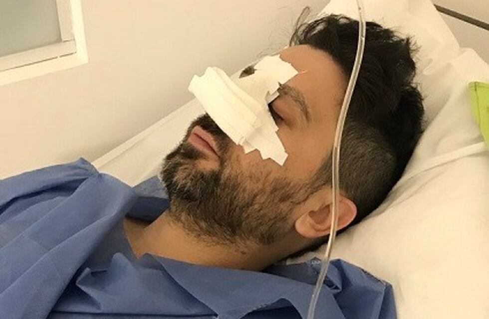 Brutal agresión tras el show de Noel Gallagher: ladrones lo desfiguraron para robarle