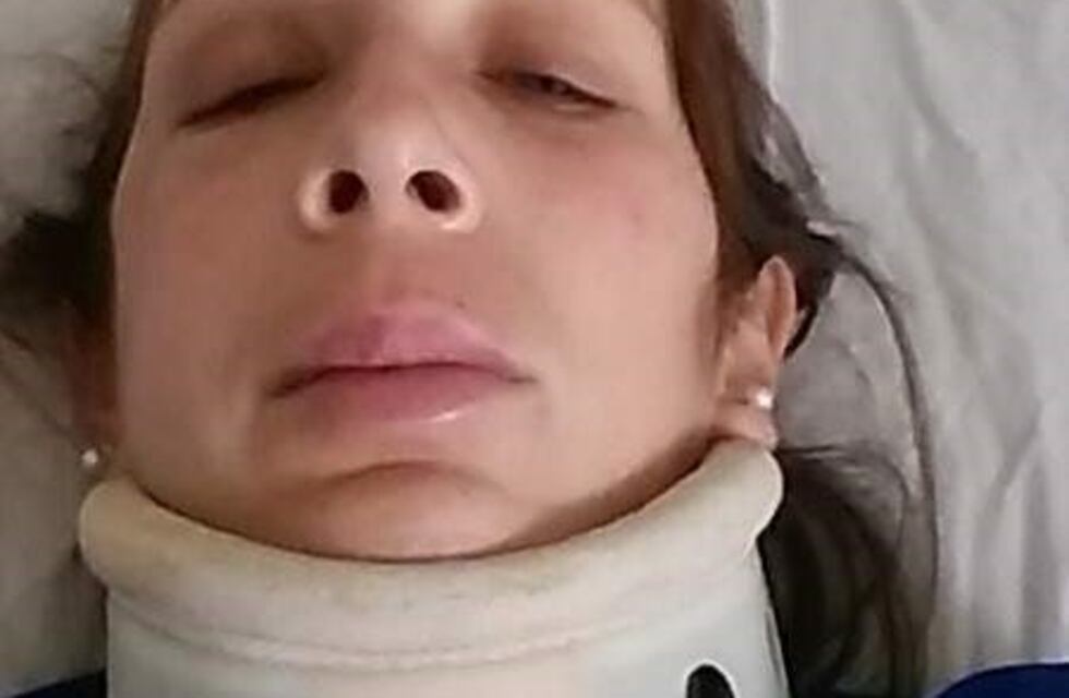 Detuvieron al hombre acusado de fracturar la cara de su ex pareja