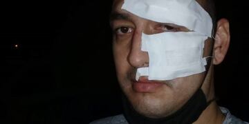 Detuvieron a 4 mayores y un menor por disturbios y lesiones a efectivos\u002E