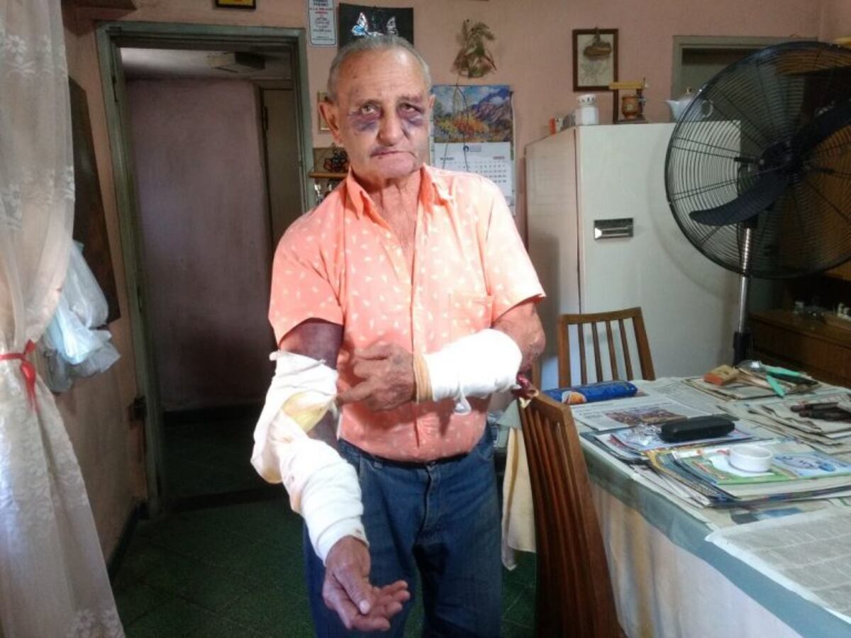 El anciano recibió una brutal golpiza en su casa de Pérez\u002E (Pedro Levy)